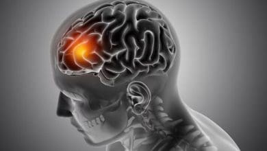 विश्व ब्रेन ट्यूमर दिवस पर ब्रेन ट्यूमर के लक्षण और बचाव