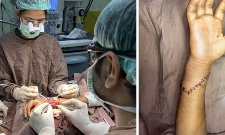 जयपुर में डॉक्टरों द्वारा बच्चे के कटे हाथ की सफल सर्जरी