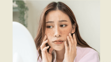 डार्क स्पॉट्स हटाने के लिए घरेलू उपाय करती महिला