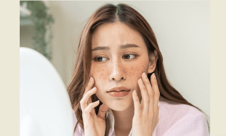 डार्क स्पॉट्स हटाने के लिए घरेलू उपाय करती महिला