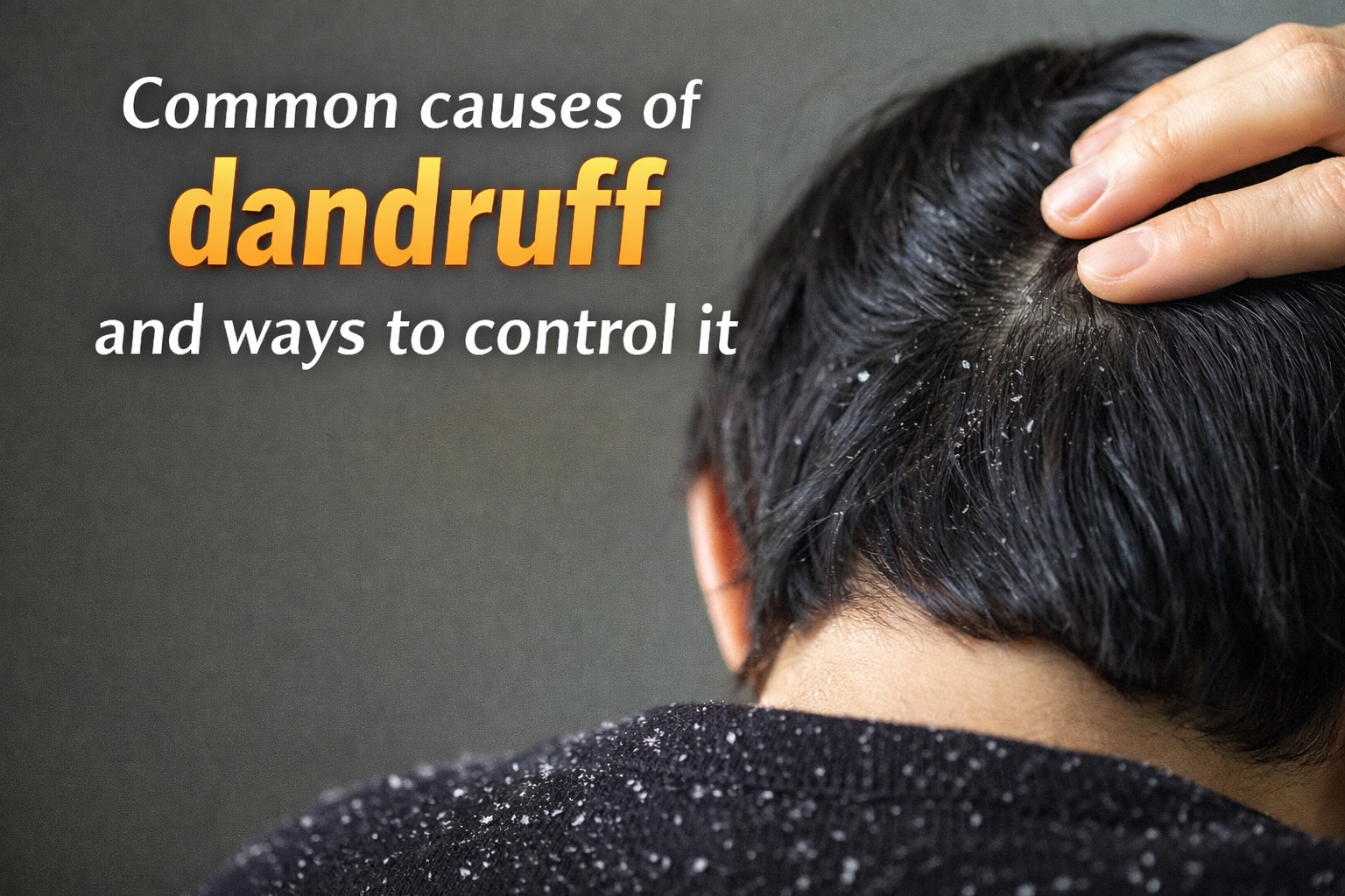 डैंड्रफ़ के कारण और नियंत्रण उपाय दर्शाती जानकारी