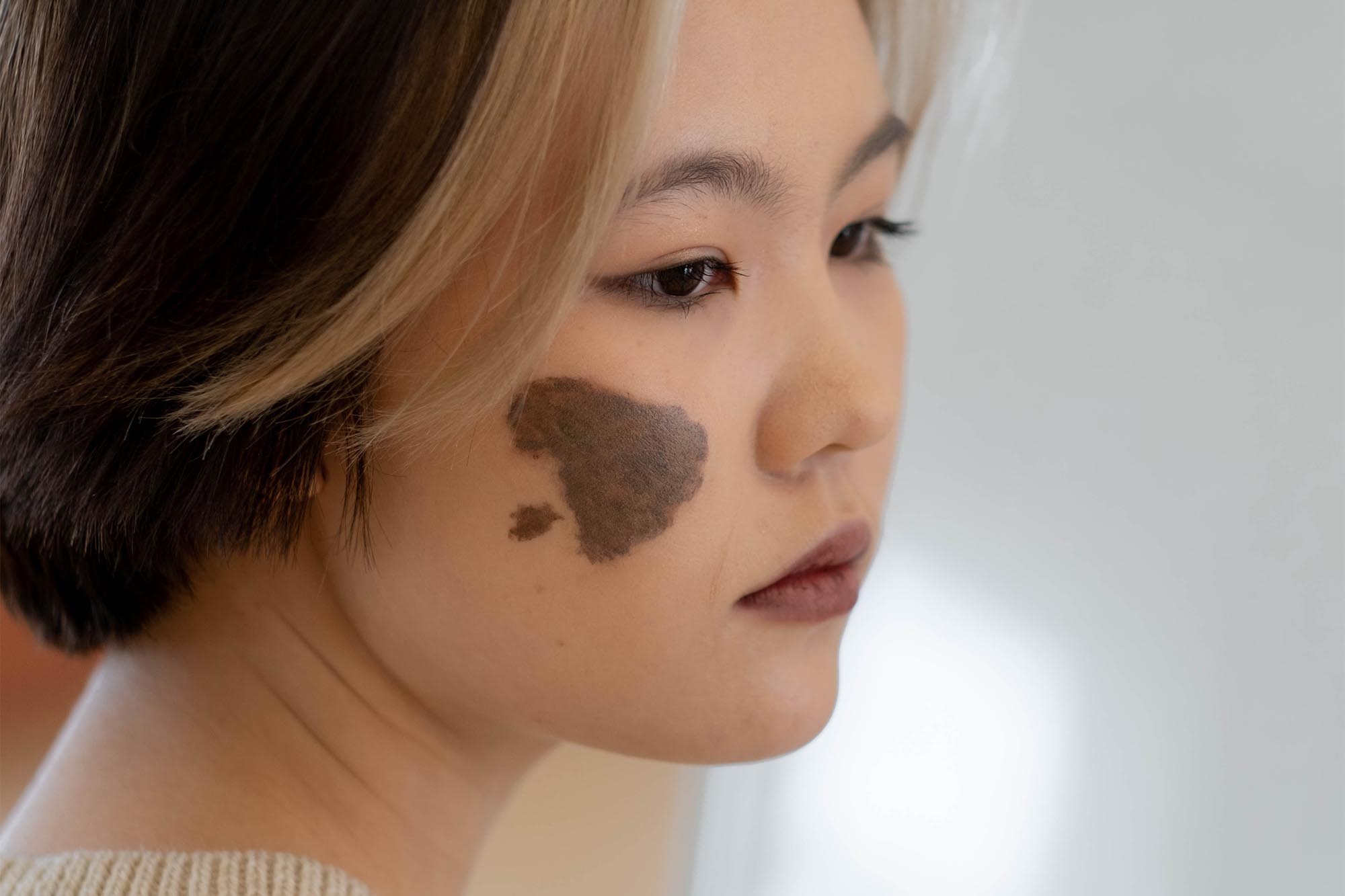 चेहरे पर बर्थमार्क: नेतृत्व और मानसिक संघर्ष का संकेत