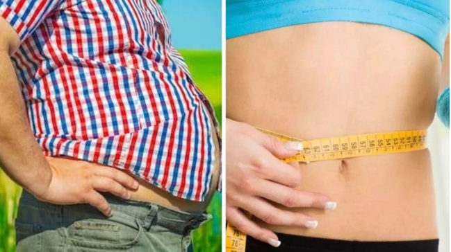 एमवायएच इंदौर में शुरू हुई मुफ्त मोटापा घटाने की सर्जरी